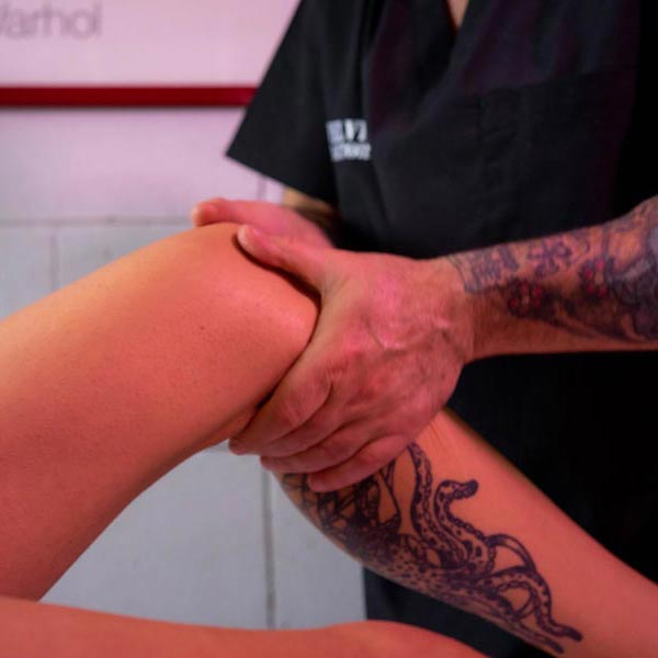 Coppettazione